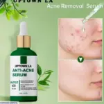 Uptown La Anti-Acne Face Serum