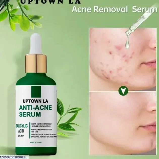 Uptown La Anti-Acne Face Serum